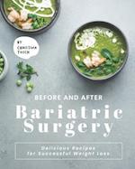 Before and After Bariatric Surgery: Delicious Recipes for Successful Weight Loss 
