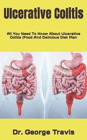 Ulcerative Colitis : All You Need To Know About Ulcerative Colitis (Food And Delicious Diet Plan