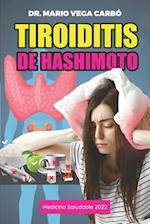 Tiroiditis de Hashimoto