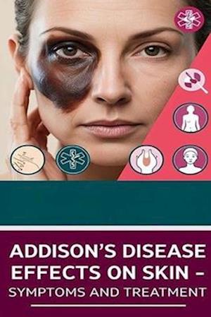 Addison's Disease Effects on Skin - Symptoms and Treatment