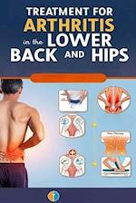 Treatment for Arthritis in the Lower Back and Hips