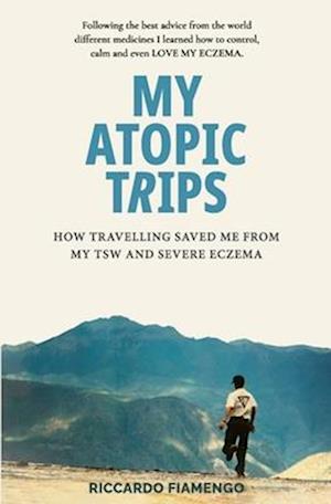 My ATOPIC TRIPS: How travelling saved me from TSW and severe Eczema