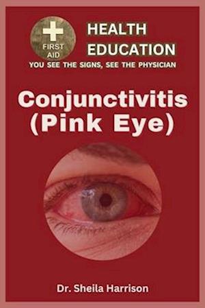 Pink Eye (Conjunctivitis): Types, Symptoms, Causes, Diagnosis, Treatment, Medications, Prevention & Control, Management