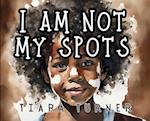 I Am Not My Spots