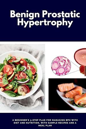 Benign Prostatic Hypertrophy