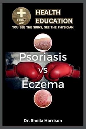 Psoriasis vs. Eczema: Differences, Similarities, Types, Symptoms, Causes, Diagnosis, Treatment, Medications, Prevention & Control, Management