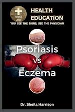 Psoriasis vs. Eczema: Differences, Similarities, Types, Symptoms, Causes, Diagnosis, Treatment, Medications, Prevention & Control, Management 