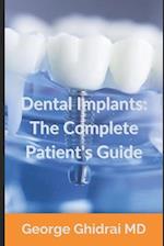 Dental Implants: The Complete Patient's Guide 