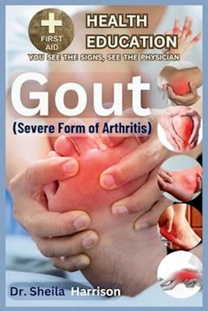 Gout