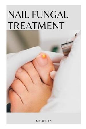 Nail Fungal Treatment