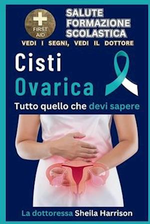 Cisti ovarica