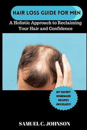 Hairloss Guide for Men