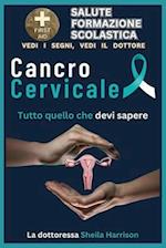 Cancro cervicale