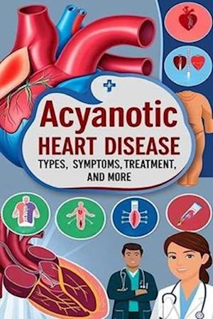 Acyanotic Heart Disease - Types, Symptoms, Treatment, and More