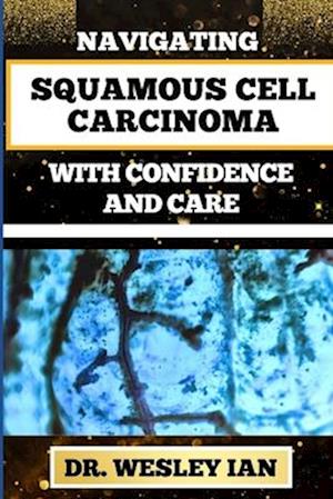 Navigating Squamous Cell Carcinoma with Confidence and Care