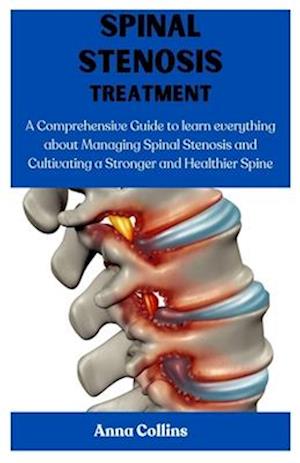 Spinal Stenosis Treatment