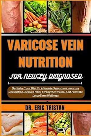 Varicose Vein Nutrition for Newly Diagnosed