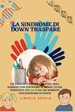 La sindrome di Down traspare