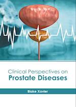 Clinical Perspectives on Prostate Diseases