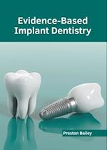 Evidence-Based Implant Dentistry