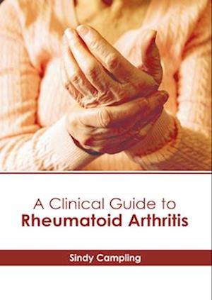 A Clinical Guide to Rheumatoid Arthritis