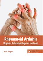 Rheumatoid Arthritis