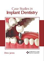 Case Studies in Implant Dentistry